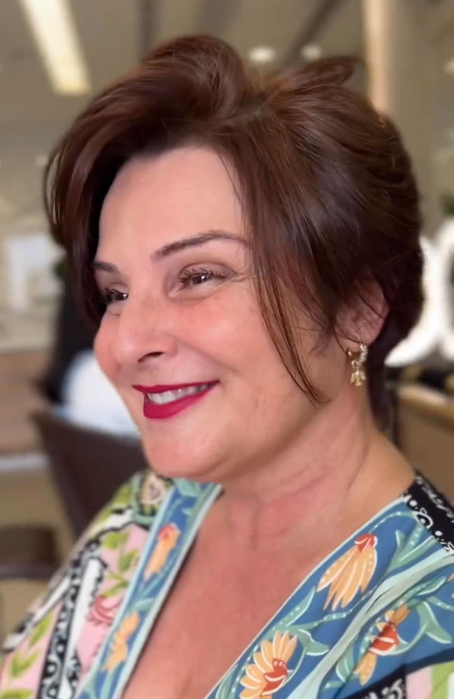 haircut stories, tiktok hair, scene hair, hair clinic, hair restoration, hairlosstalk, hair clinic near me, hair loss treatment, hair transplant near me, prom hairstyles,