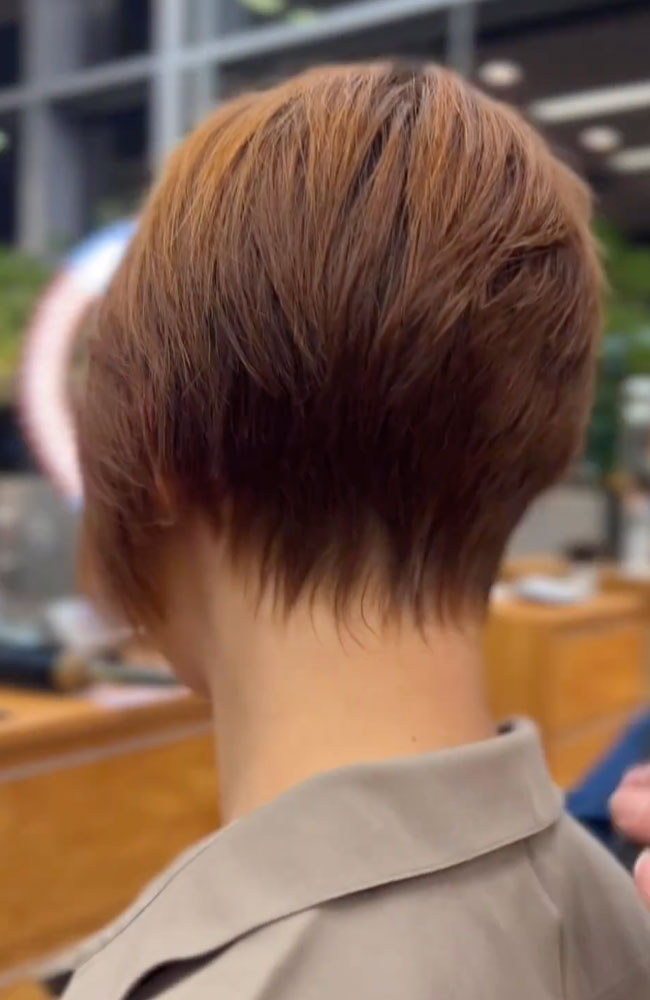 haircut stories, tiktok hair, scene hair, hair clinic, hair restoration, hairlosstalk, hair clinic near me, hair loss treatment, hair transplant near me, prom hairstyles,