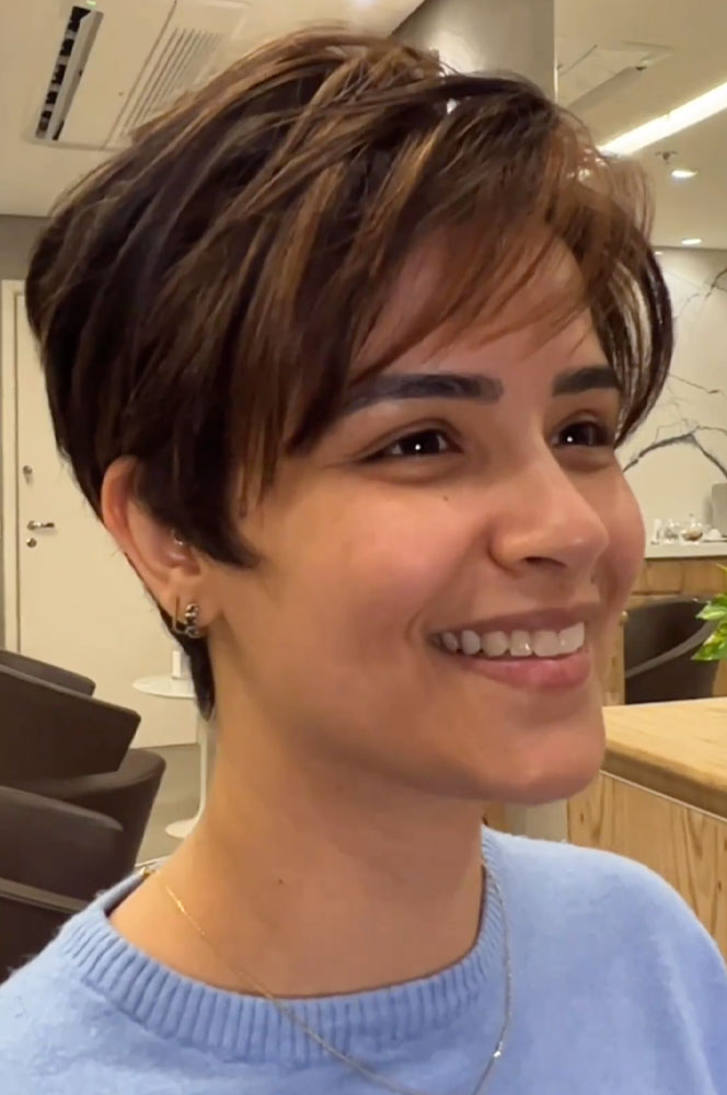 haircut stories, tiktok hair, scene hair, hair clinic, hair restoration, hairlosstalk, hair clinic near me, hair loss treatment, hair transplant near me, prom hairstyles,