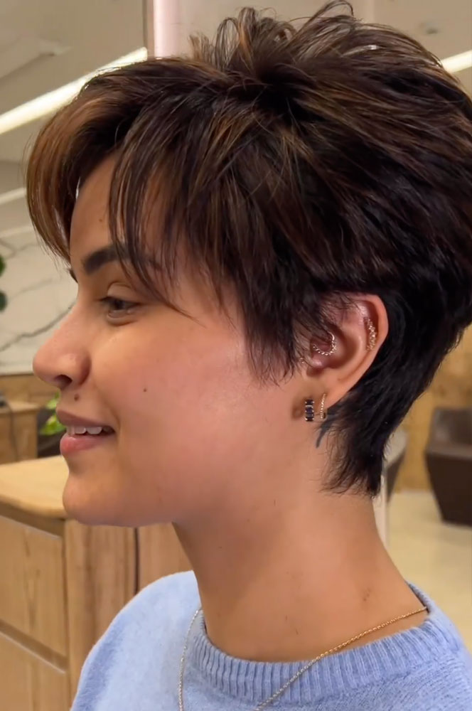 haircut stories, tiktok hair, scene hair, hair clinic, hair restoration, hairlosstalk, hair clinic near me, hair loss treatment, hair transplant near me, prom hairstyles,